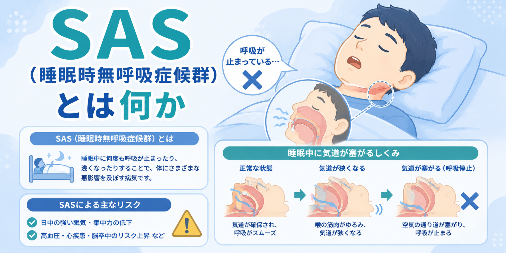 SASとは何か